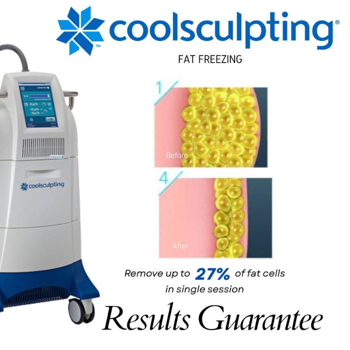 Coolsculpting Johor Bahru (JB) | Aesthetic Clinic Johor Bahru (JB) | Aesthetic Treatment Johor Bahru (JB)
